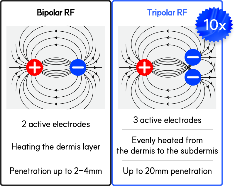 bipolar RF vs tripolar RF